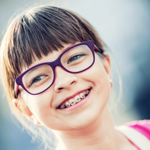 Braces For Children | Specialist Orthodontist In Nundah | Wired